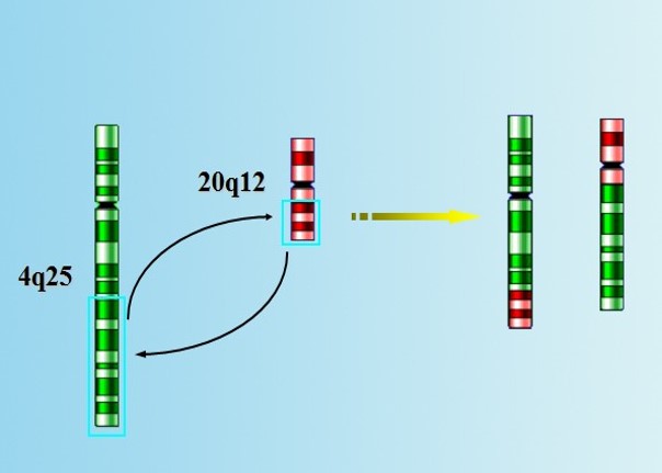 染色体结构异常