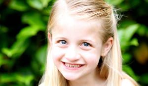 天使人综合征（Angelman syndrome）