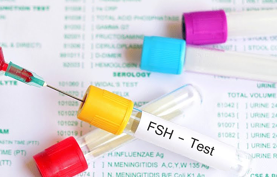 FSH是什么？FSH值高意味什么？