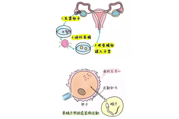 做试管婴儿过程疼吗