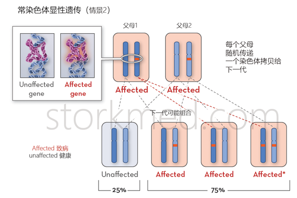 大疱性表皮松解症