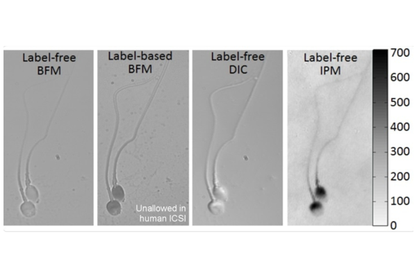 精子细胞成像技术
