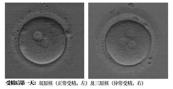 fa57ab79f2262268f3a720b44c5498dc.jpg fa57ab79f2262268f3a720b44c5498dc.jpg