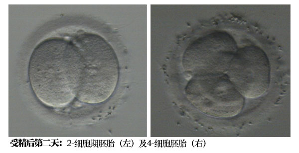 a28db362cb61104c4fdd45e9be927e62.jpg a28db362cb61104c4fdd45e9be927e62.jpg