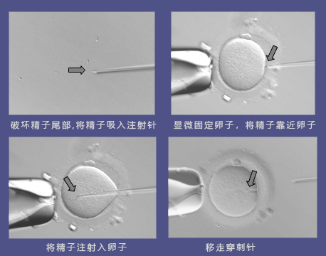 顶体酶低试管质量差？