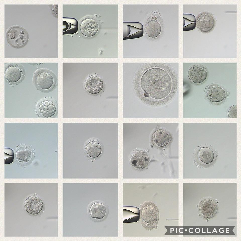 常见的卵子缺陷有哪些？