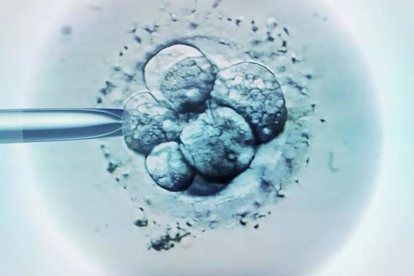 胚胎移植期间会发生什么情况