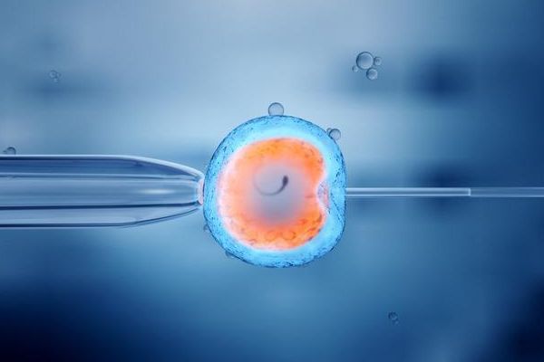 IVF，ICSI婴儿与其他婴儿一样健康
