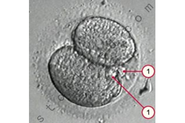 极体胚胎 极体胚胎