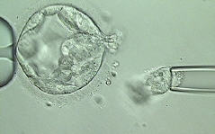 囊胚培养