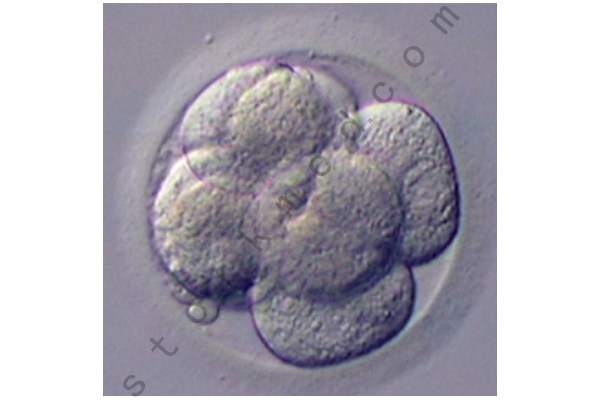 八细胞胚胎 八细胞胚胎