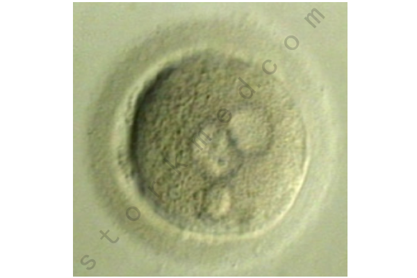 卵母细胞 卵母细胞