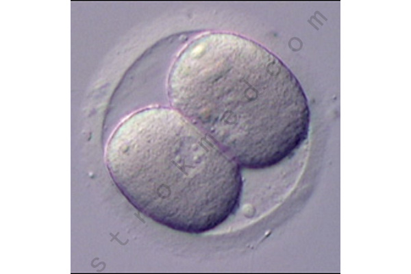 双细胞胚胎 双细胞胚胎