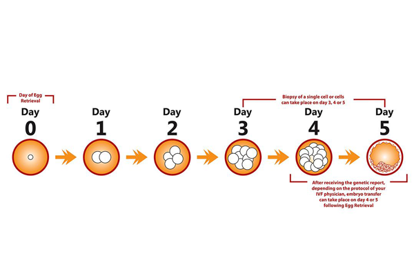 PGD技术在试管婴儿治疗中的作用