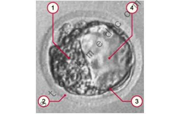 囊胚第五天时的图片 囊胚第五天时的图片