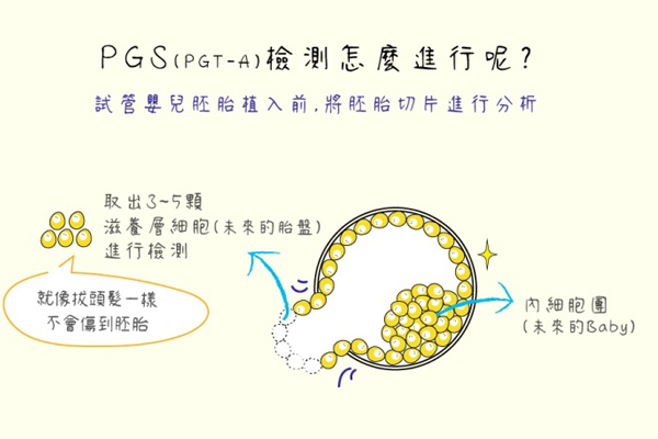 什么是试管婴儿胚胎植入前基因检测(PGT)？