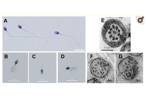 70743b56d317c54ac9e7e72a7ff1f43b.png 70743b56d317c54ac9e7e72a7ff1f43b.png