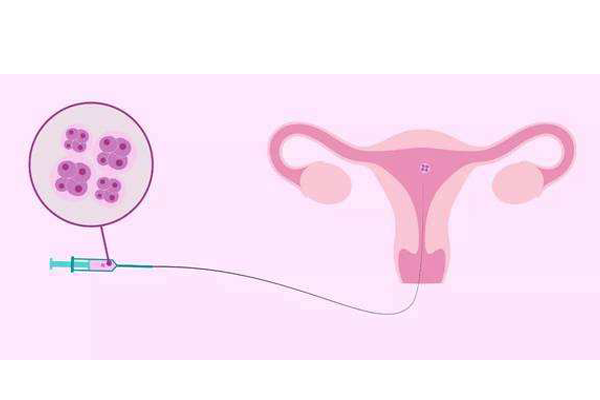 影响胚胎植入成功的因素有哪些