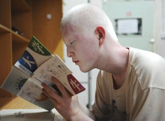 白化病患者可以生出健康的孩子吗？