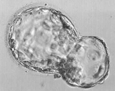 胚胎的分级标准