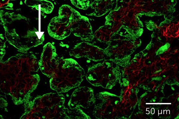 空气污染与女性备孕