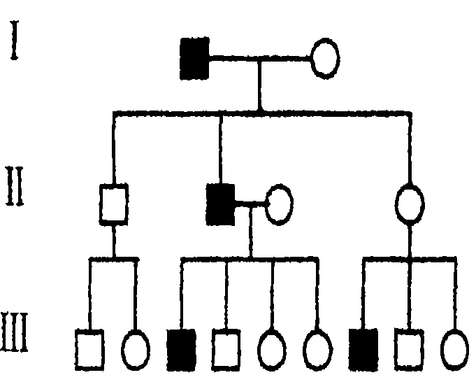 遗传性早秃的模式家系图