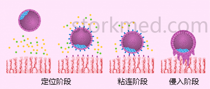 257a7e7bab62674671262856eaf673f8.jpg 257a7e7bab62674671262856eaf673f8.jpg