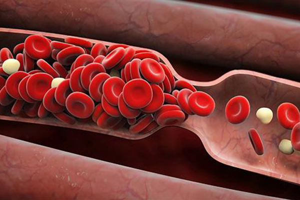 抗磷脂抗体综合征如何影响妊娠