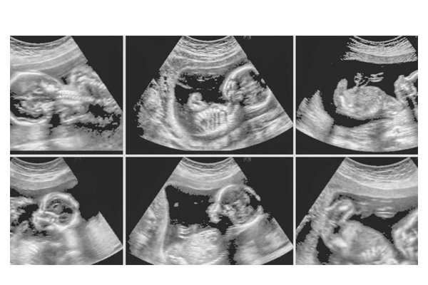 b19817f815dd8e3a1ccbc3d438612b04.png b19817f815dd8e3a1ccbc3d438612b04.png